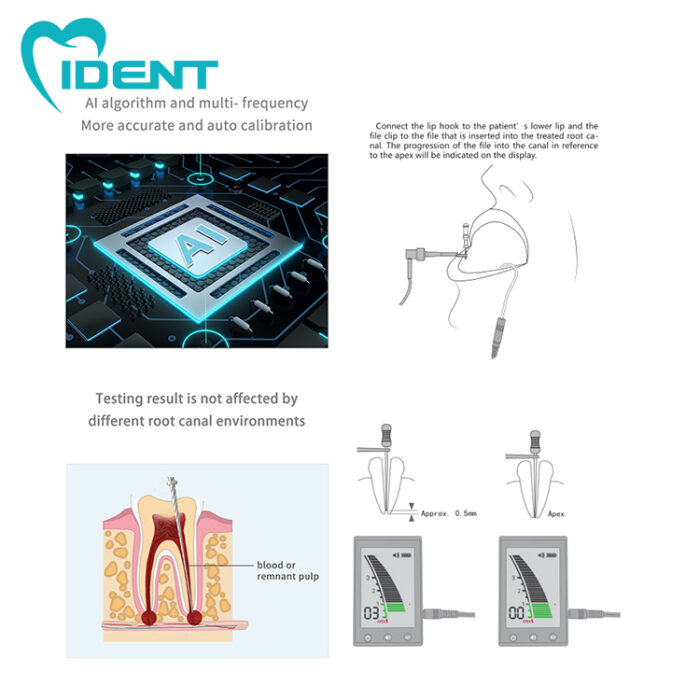 Dental Laboratory MINI Micropex Surgical Root Canal Apex Locator Root Canal Measurement Portable Machine Dentistry Tool - Image 3