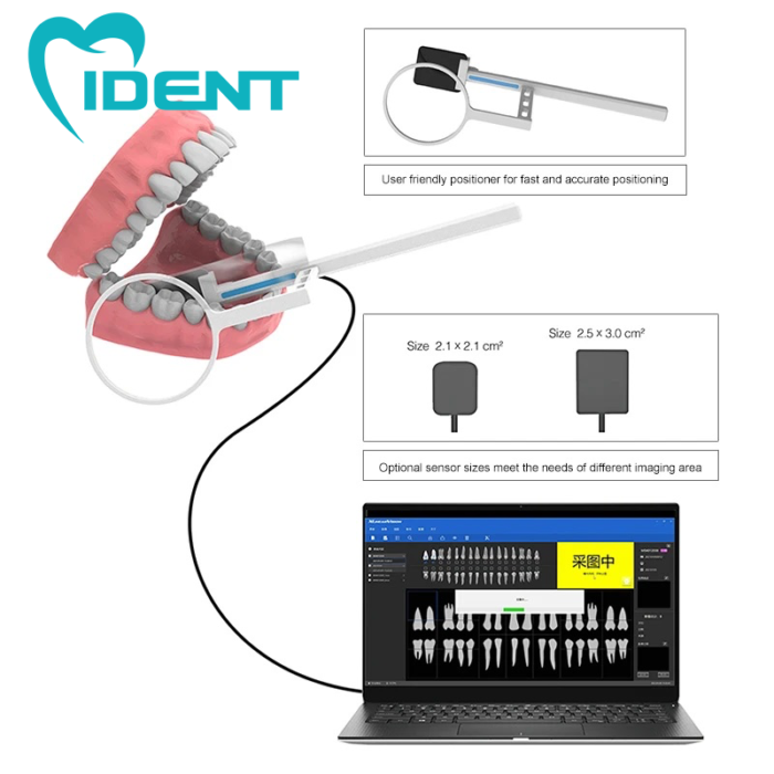 Dental Sensor Digital X-Ray Sensor Xray Intraoral System HD - Image 3