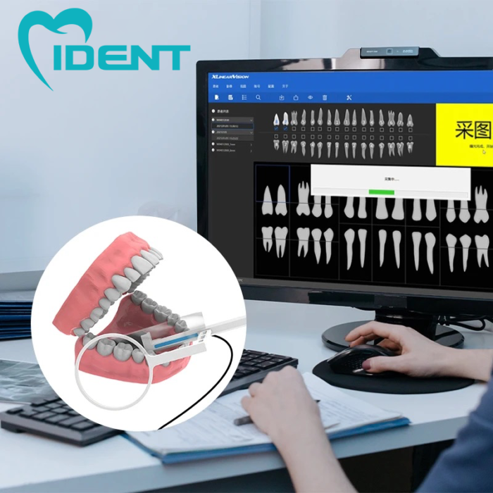 Dental Sensor Digital X-Ray Sensor Xray Intraoral System HD - Image 5