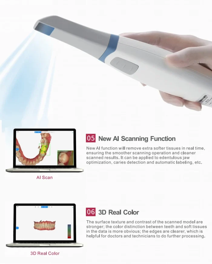 Dental 3D Scanner Digital Intraoral Scanner SystemDental Lab Equipment Digital Impression System - Image 6