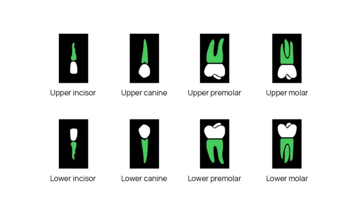 Dental x-ray machine - Image 11