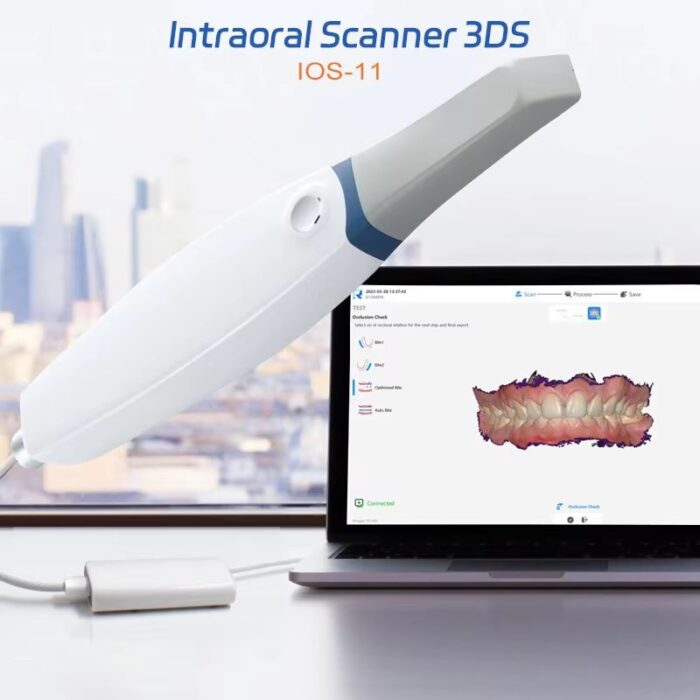 Dental 3D Scanner Digital Intraoral Scanner SystemDental Lab Equipment Digital Impression System