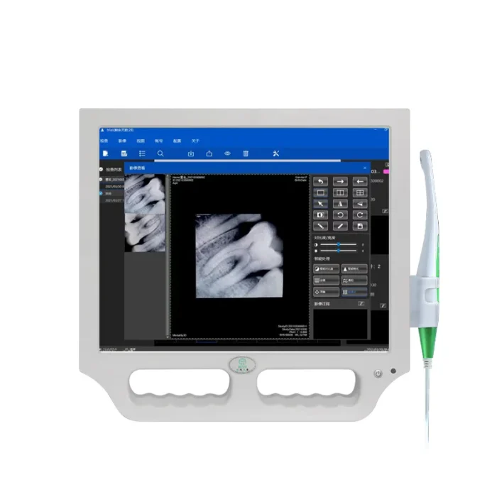 Portable Intraoral Camera with Monitor: Electric Dental Equipment