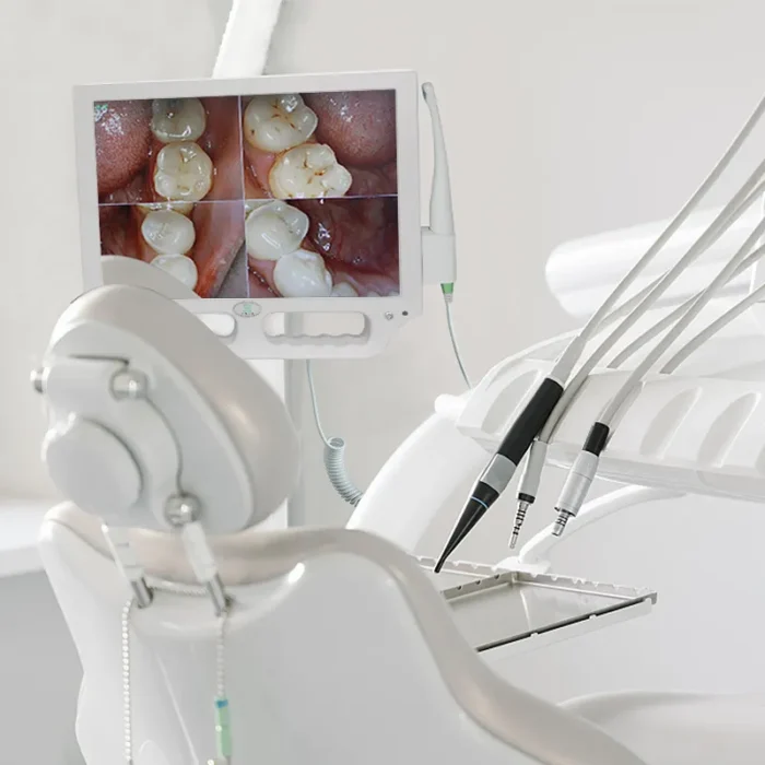 Portable Intraoral Camera with Monitor: Electric Dental Equipment - Image 6