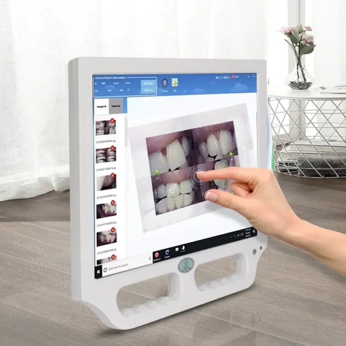 Portable Intraoral Camera with Monitor: Electric Dental Equipment - Image 4