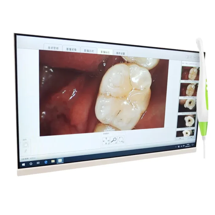 Dental Endoscope Intraoral micro camera dental intra oral camera 24 inches touch screen hd - Image 5