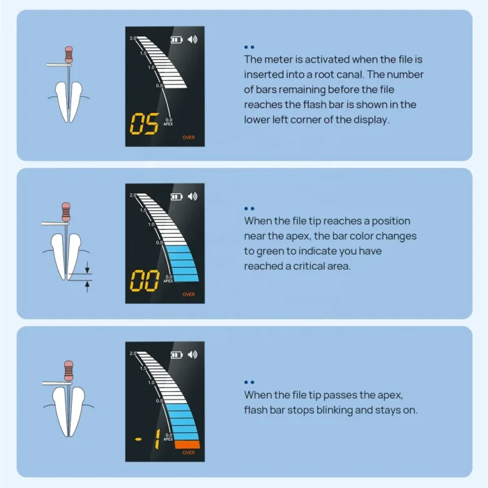 Dental Endo Apex Locator Root Canal Measurement Dentistry Tool for Dentist - Image 4