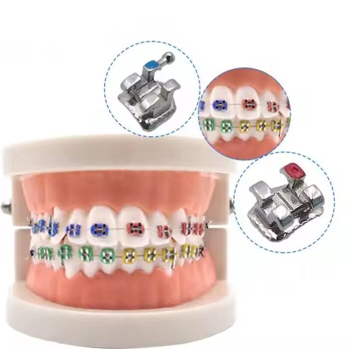 Orthodontic Bracket - Image 2