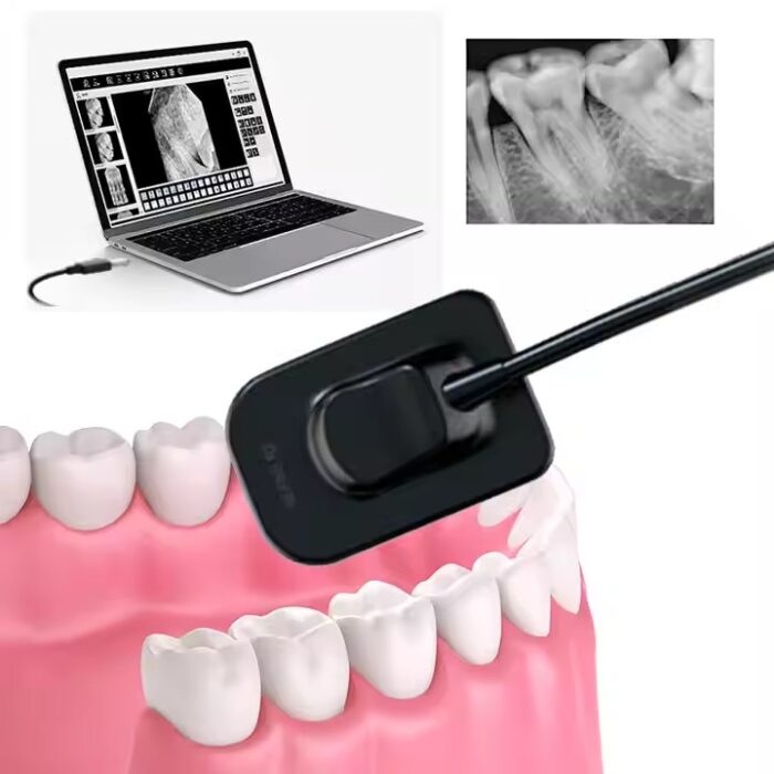 Original DBA i-Sensor H2 Big Size Intraoral Imaging System Digital Dental Sensor X-Ray Thinner Clearer Smarter Dental Sensor - Image 2