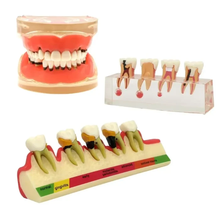 Dental Teeth Model Teaching Study Demonstration Tool Model Dentist Student Model for Teaching Kilgore Nissin ,Frasaco Colombia - Image 3