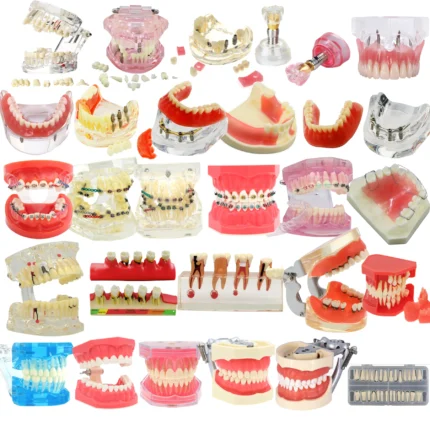 Dental Teeth Model Dental Teaching Model Standard Implants Models Orthodontic Model Dentistry Dentist Demo Studying