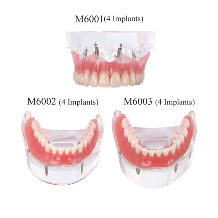Dental Teeth Model Teaching Study Demonstration Tool Model Dentist Student Model for Teaching Kilgore Nissin ,Frasaco Colombia - Image 5