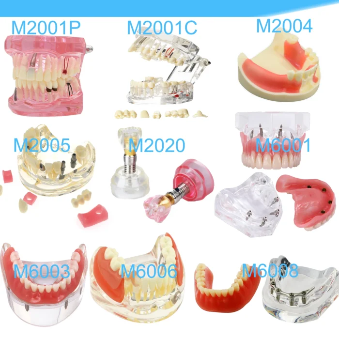 Dental Teeth Model Dental Teaching Model Standard Implants Models Orthodontic Model Dentistry Dentist Demo Studying - Image 5