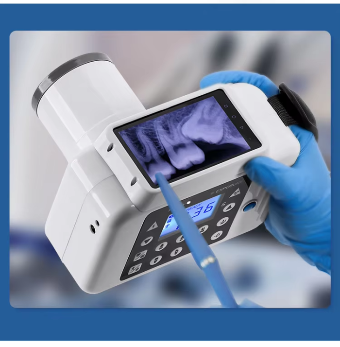 Dental Equipment Digital Versatile Oral Camera with Built-in Display Dental X Ray Machine - Image 5