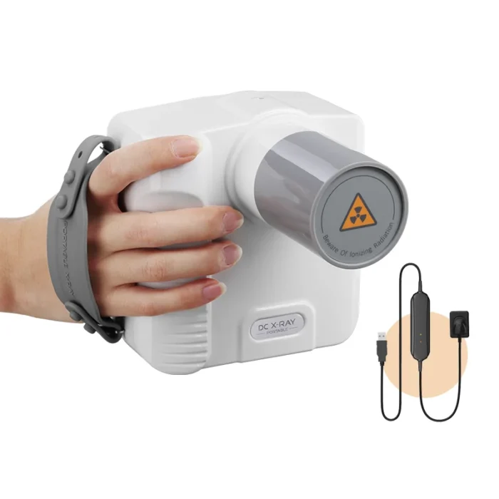 Dental Digital Vet Xray Machine Portable Price - Image 2