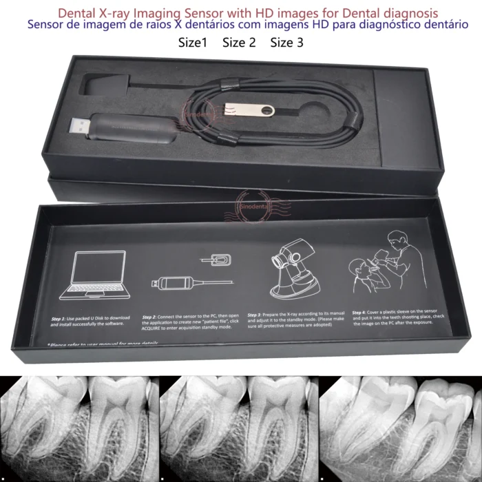 2024 Hot Sale RVG Dental Sensor with Holder Faster/Recycle/Durable USB Dental X Ray Sensor IntraOral Camera Digital RVG Sensor - Image 2